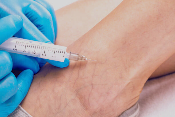 Cosmetic Spider Veins - In-Person - One Day