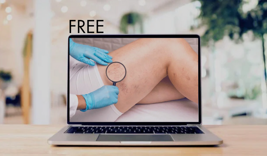 FREE ONLINE MINICOURSE: How to Select Patients for Cosmetic Spider Vein Treatment